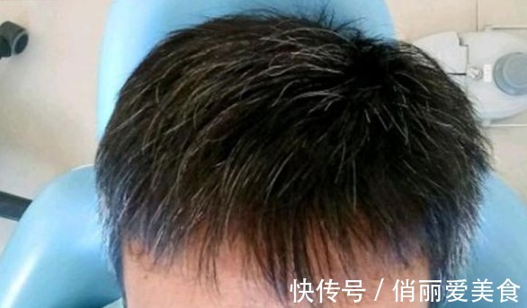 秘方 民间一个土秘方,不管白发多严重,让你从此告别染发,了解一下
