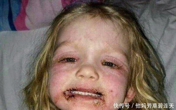 化妆品|女儿用过父母送的化妆品后,几乎毁容,原来美国也有山寨货