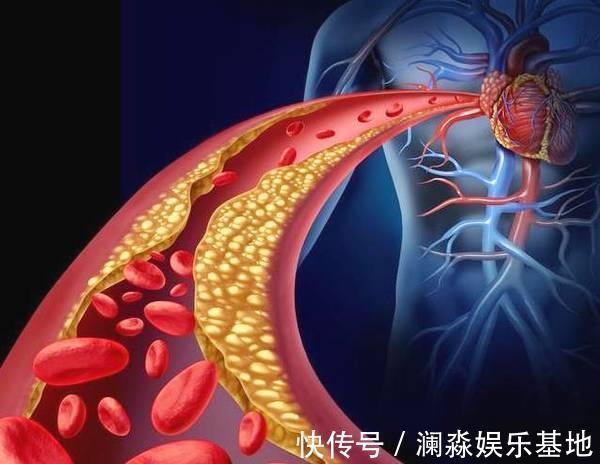 软化血管|1种粗粮，是降甘油三酯“高手”，捣碎泡水喝，通血管、血脂降了