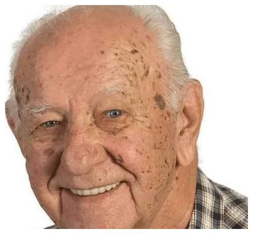 西红柿|岁数大了容易有老年斑？若能做好3件事，或许老了也干干净净