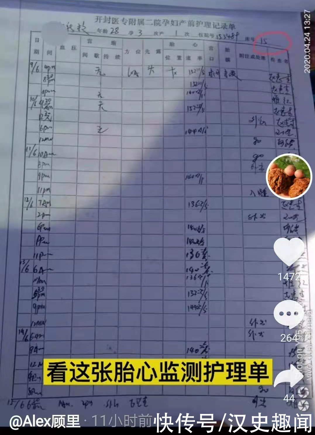 血常规检查|郑引19号开的医嘱,18号提前被送去检验,假医嘱暴露孩子出生日期