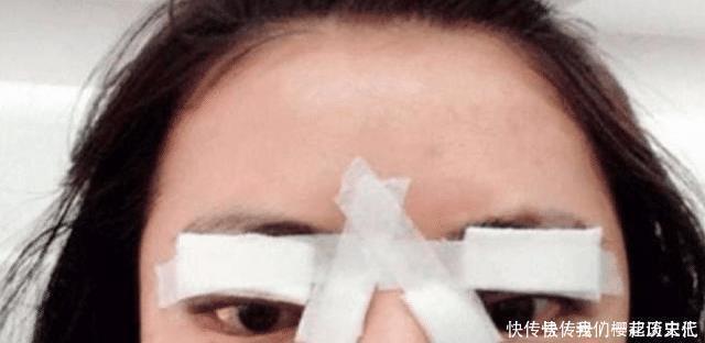 割完“双眼皮”的人,老了之后会变成什么样说出来你可能不信