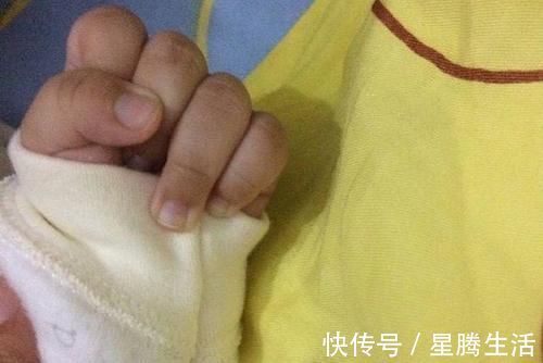 婴儿|9个月婴儿紧握拳头,奶奶发现有问题带去医院检查,医生:来晚了