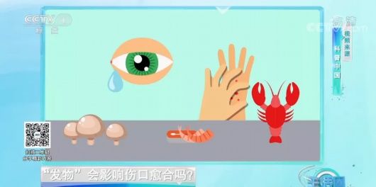 糖尿病人|糖尿病人不能吃水果、高血压患者不能吃柚子？这些“忌口”没必要