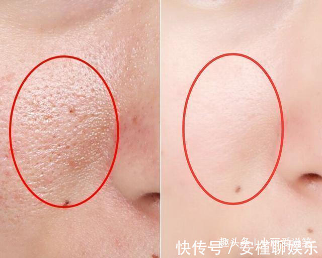 艾文馨|中国有6种“尴尬”护肤品,放超市货架无人问津,却比兰蔻还好用