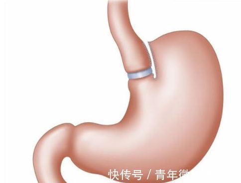 浅表性胃炎|幽门螺旋杆菌的“克星”被发现,早晚1勺,大小胃病永不“打扰”