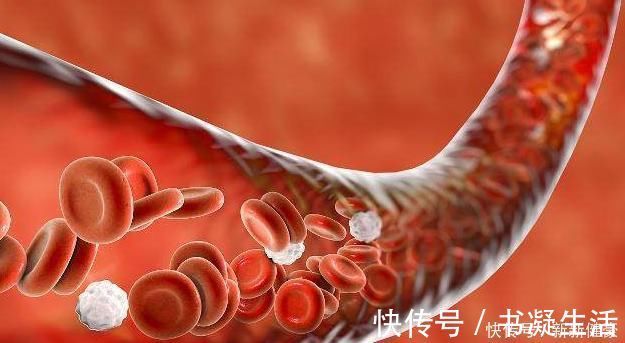 心血管疾病|4种“碱性食物”经常吃,排出体内毒素,给血管“洗个澡”!