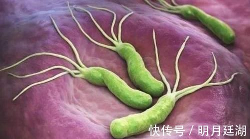 病变|被胃癌“喜欢”的人，一般都有这5个特点！希望你没有