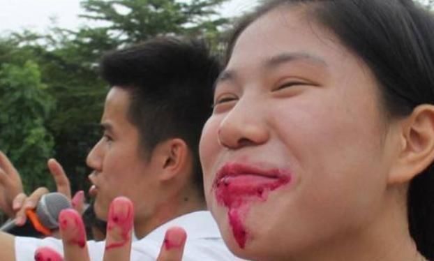 肠胃疾病|2岁宝宝突然“尿血”，妈妈哭着去医院，医生：这东西别给孩子吃