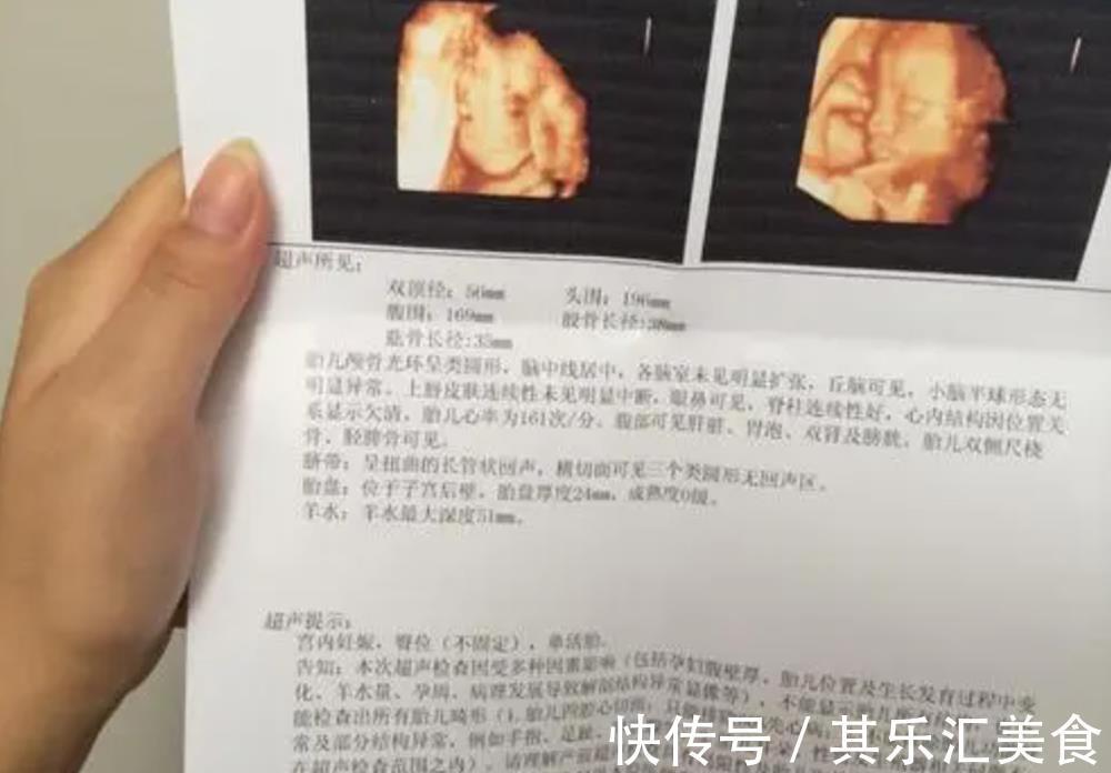 宝宝|四维彩超背后隐藏的几个“误区”,孕妈别再傻傻相信了,真没必要