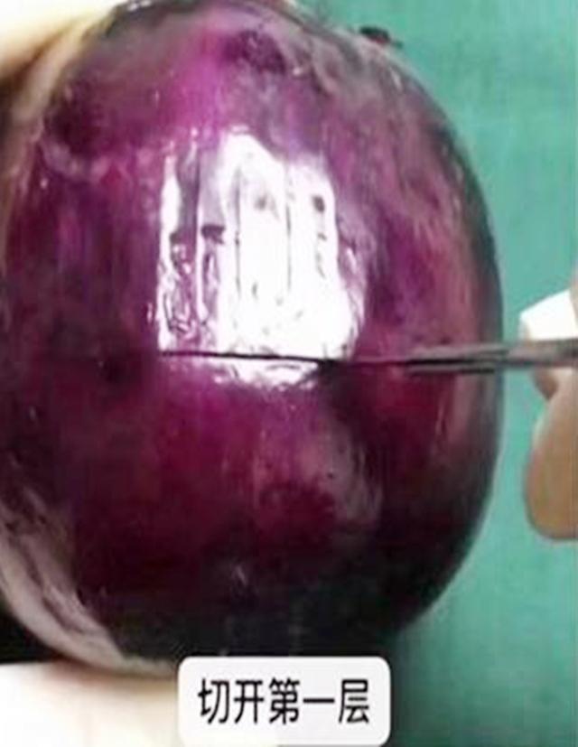 麻醉针|选剖腹产不疼这根10厘米的麻醉针仅仅是开始,疼到你怀疑人生