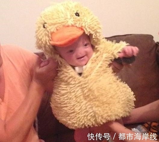 长大|婴儿出生就没有鼻子,父母觉得很可爱,孩子长大后再决定是否手术