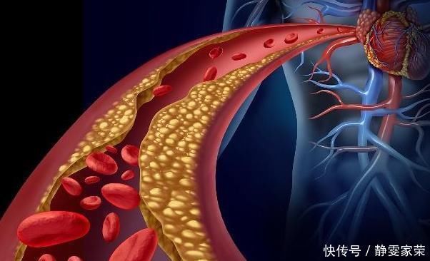 黄芪泡水|一天一杯“黄芪水”,一段时间后,身体会悄悄发生4个“变化”