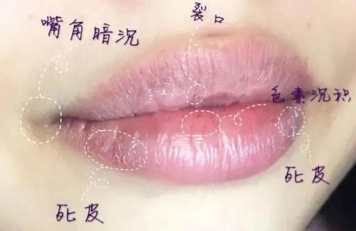 长期涂口红的女生，嘴巴这5个问题很明显，中两个就该注意了！