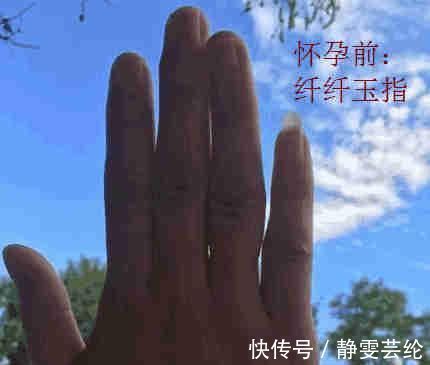 戒指|孩子还没开始生,却惊动了消防官兵,实在太丢人了