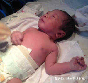 医生|“丑宝宝”被全家人嫌弃,医生却说孩子颜值很高,一个月后奇迹了