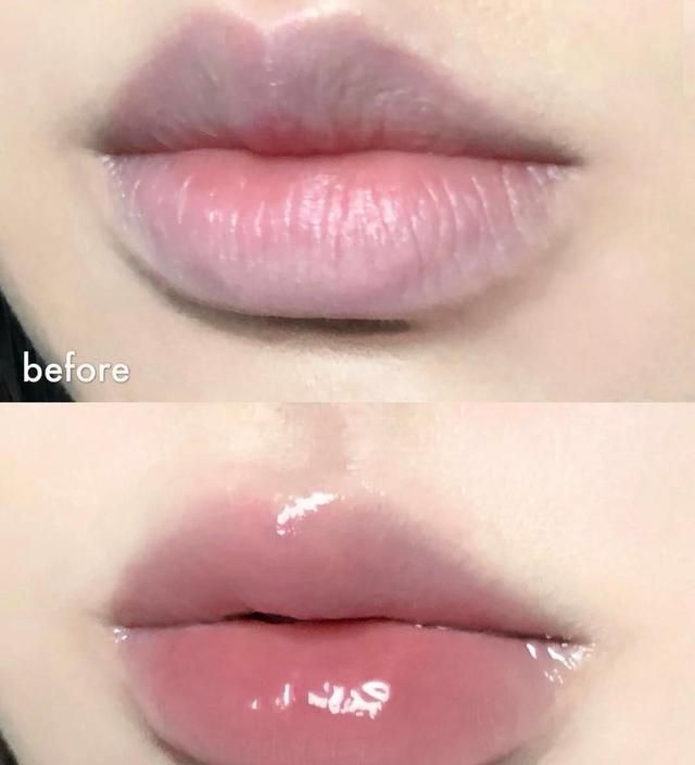 唇皮|嘴唇干裂如何快速“修复”?睡前简单三招,唇干女生“秒变嘟唇”