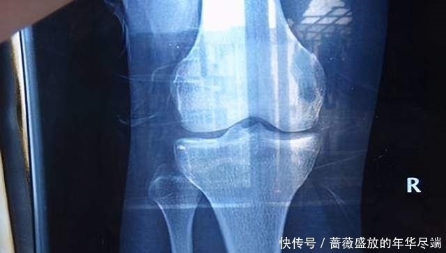 大长腿|家长矮孩子就一定矮吗？抓住三个“猛涨期”，想有个大高个不是梦