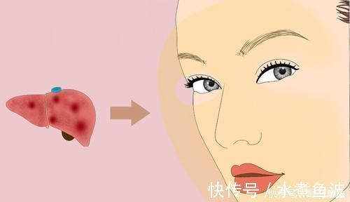 黄疸症|肝脏逐渐变好时,身体有3处会慢慢变色,多占一个也值得恭喜