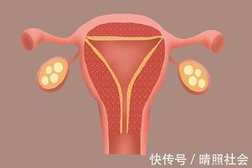 甲状腺结节|体检查出的结节、增生和息肉,哪些会癌变,哪些不要治?