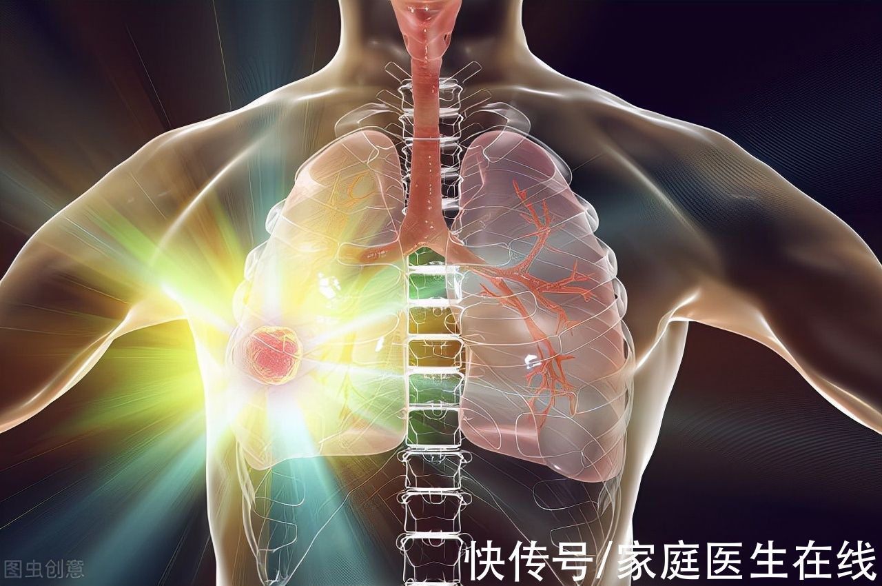 癌症|手术、化疗、热疗…癌症治疗的6个方法，选择正确是关键