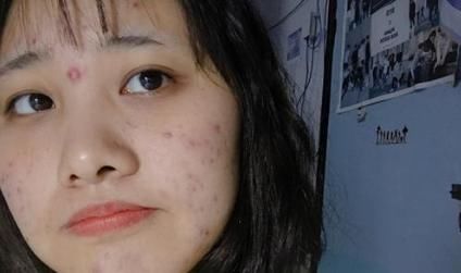 2物是身体“加湿器”，越吃湿气越多，很多人却爱不释口