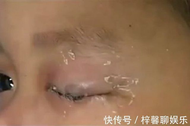 医生|孩子将502滴入眼睛,爸爸的应急措施,医生都大赞幸亏处理及时