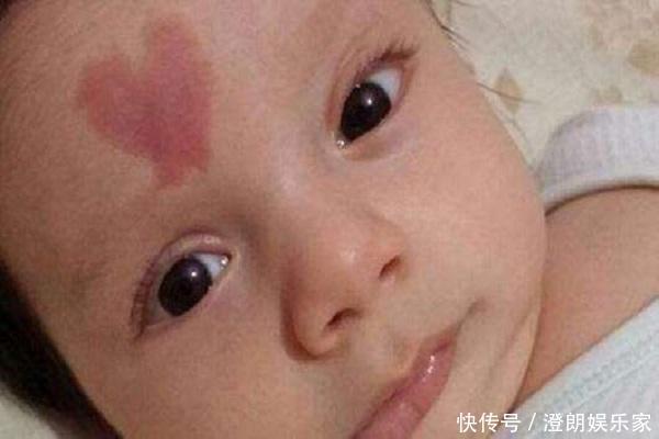 小静|孕妇在孕期这两个事情要注意,会让胎儿长胎记,很多孕妇忽略了