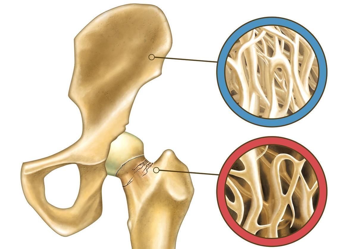 雌性激素|女性绝经后,身体会有哪些变化医生提醒这3个方面要多注意
