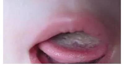 西红柿|夏季孩子脾虚积食多，少吃“2红”，多吃“2黄”，或能消积健脾