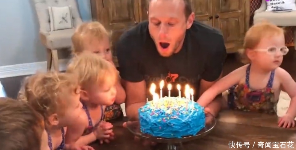 奇迹|女子以为怀的双胞胎，医院检查才知道，创造了500年一次的奇迹