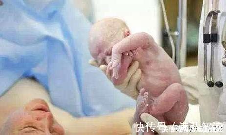 医生|现实版“哪吒”,产妇生下“带壳”宝宝想遗弃,医生:你太幸运了