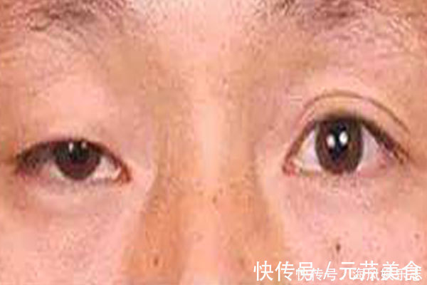 脸上有张“疾病地图”,哪里生病了,它会“告诉你”,快对照自检