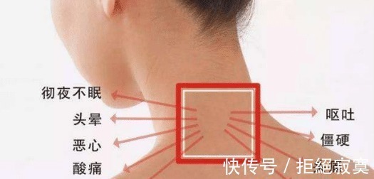 颈椎|颈椎病反复不好,一样小物就能解决,身边有颈椎病的可以保存了!