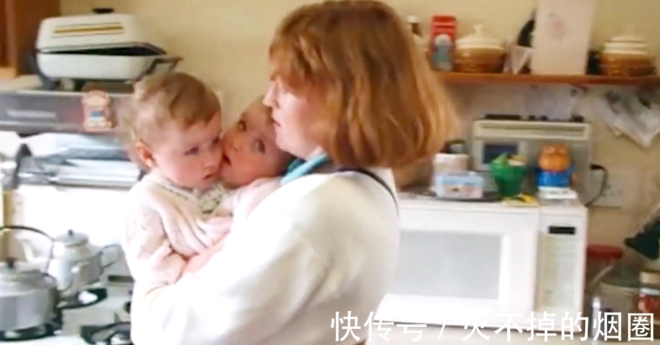 索菲亚|2女孩共用一个躯体生活3年,要将她们个体分离,能成功吗?