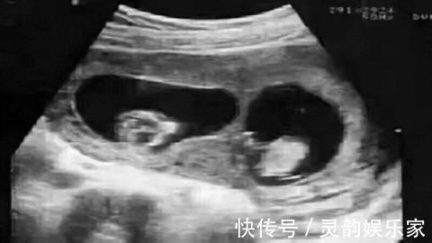 小黄|夫妻生娃DNA检测却是“叔叔”的,可爸爸是独生子!真相令人目瞪口呆