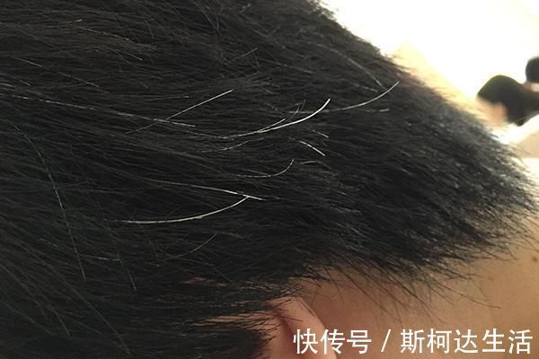 长白发能不能变黑 只要吃对食物 白发或会慢慢变黑 注意了解 快资讯 长白发能不能变黑 只要吃对食物 白发或会慢慢变黑 注意了解 快资讯