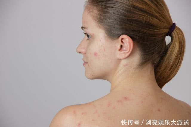 湿气重的人,身体会有5种表现,健康祛湿,教你五招