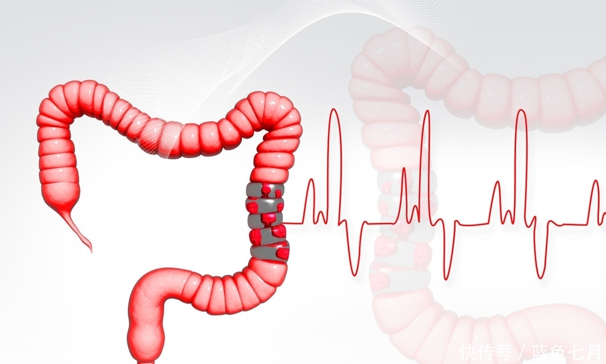 爱吃|木耳虽好,冬季吃木耳,小心2种吃法变“夺命符”,爱吃的人牢记