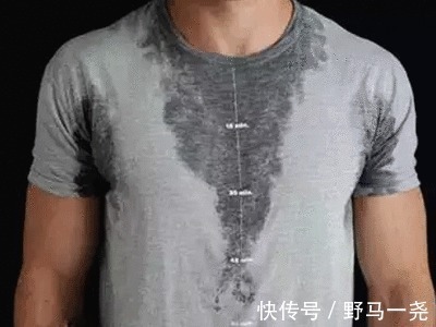 灼热感|皮肤出现3个信号,警惕糖尿病“恶化”!做好2点,远离并发症