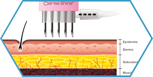 医美 30+后的你如何抗初老呢?「医美抗初老」让你一步到位!