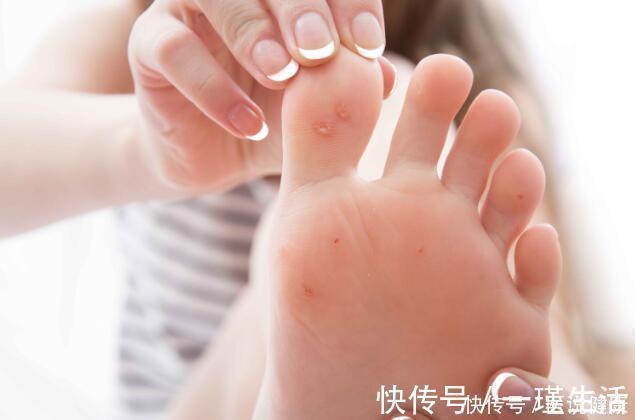 皮肤|得了糖尿病,皮肤若有这4种现象,说明体内血糖超标,要引起重视