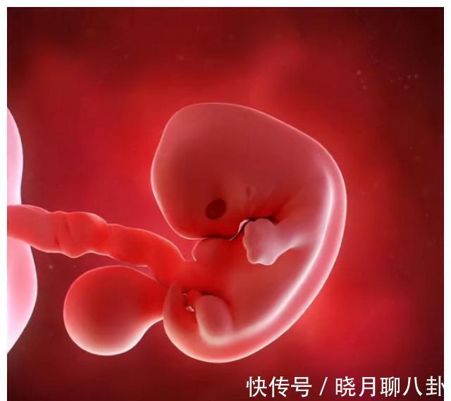 先天性心脏病|有多少孩子产检没问题,却出生后发现有问题?四种情况孕检查不出