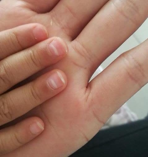 玮玮|2物是长个“抑制剂”,娃儿经常吃身高或会减少9公分