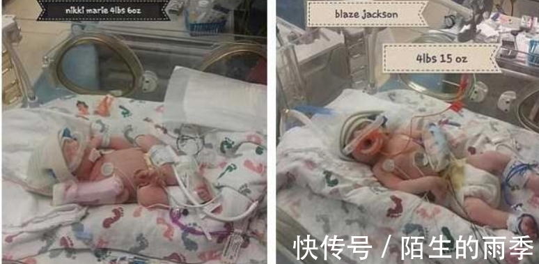 三胞胎|腹痛难忍以为是结石,竟连续生下三胞胎,医生:怀孕34周都不知道