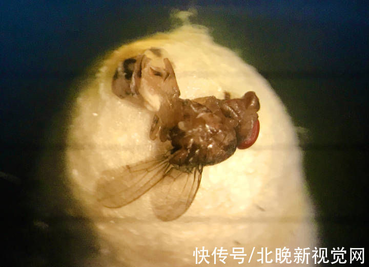 虫子|50岁大妈眼内竟有一只“苍蝇”？！医生：幸运的是……