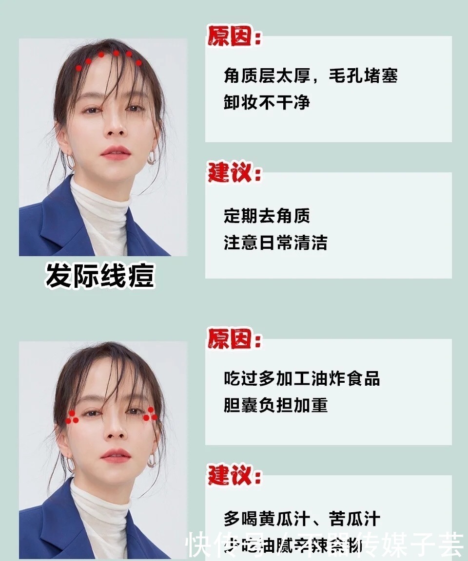 生冷食物|二十几了还长痘?别再用烂脸的招数了,几招教你养出水润肤质