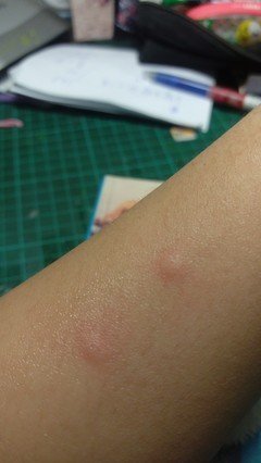 腹部|湿气重的人，身体3处是“圆”的，如果你也有，尽早祛湿