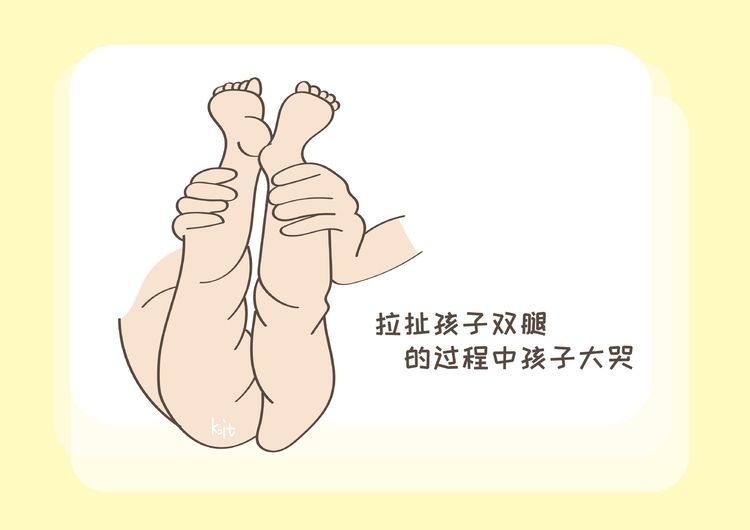 宝宝|宝宝的大腿纹为啥不对称？这是什么情况？带你一起了解下