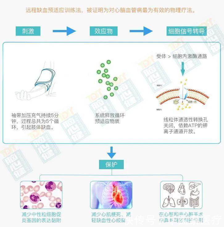 中风|每天久坐8小时,中风风险高7倍